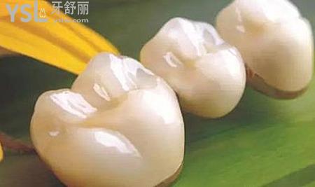 我是該補牙還是做烤瓷牙哪一個好？