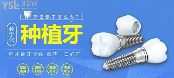 晉江金榜口腔種植牙優(yōu)勢