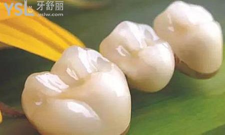 全瓷牙可以洗牙嗎？