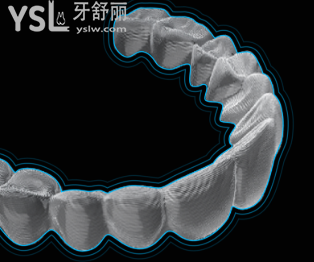 正雅隱形牙套價(jià)格多少錢