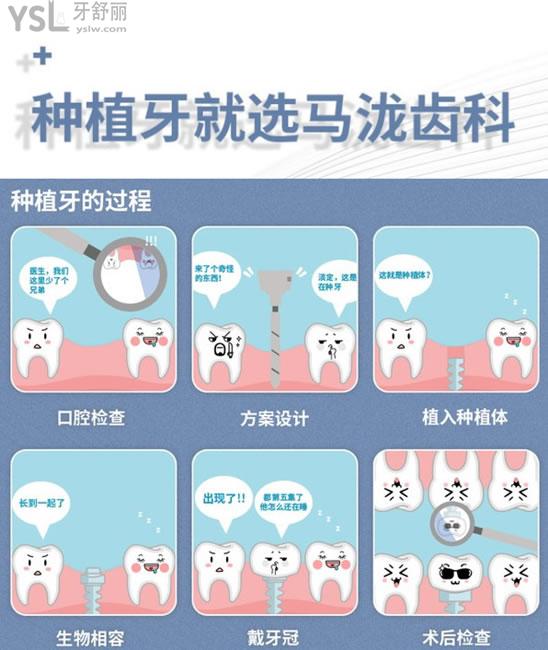 鄭州馬瀧齒科種植過程圖