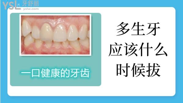 多生牙什么時(shí)候拔掉