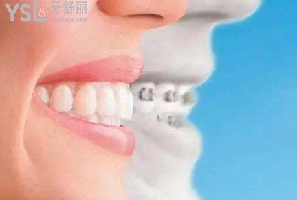 福建晉江金榜口腔醫(yī)院進口隱形矯正立減10000元！