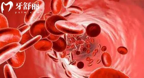 為什么患有糖尿病的人不能拔牙？還有哪些人也不能拔牙？
