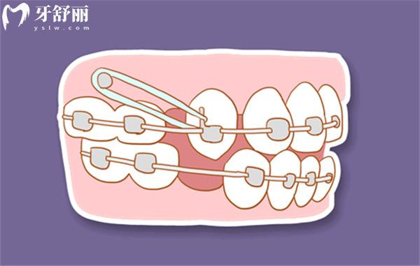 重慶口腔醫(yī)院拔牙多少錢(qián)