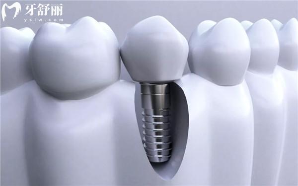 漢中口腔醫(yī)院價目表