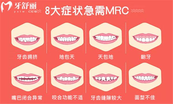 安順牙齒矯正多少錢