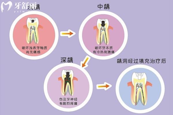全新西安牙科醫(yī)院報(bào)價(jià)表