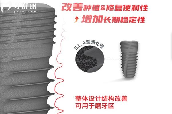 、韓國(guó)易普萊種植體質(zhì)量怎么樣
