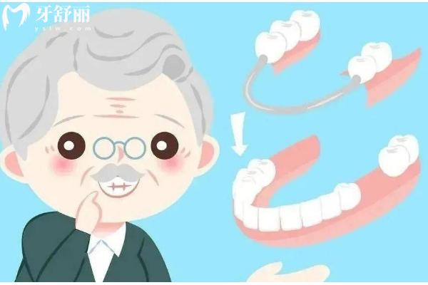 2025重慶老年人裝假牙大概多少錢？幾千到1w價(jià)格不一 附重慶不錯(cuò)的口腔醫(yī)院