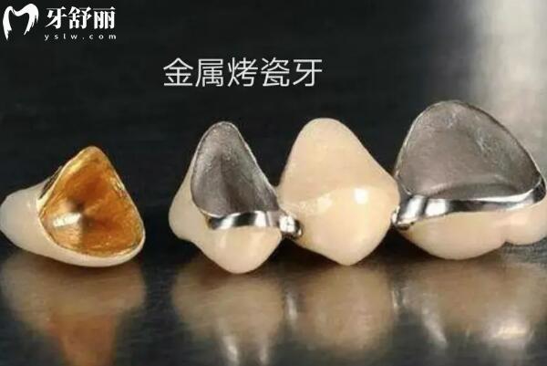 曲靖舒爾口腔醫(yī)院收費標準:2025年種植牙1580+全瓷牙980+矯正8000+