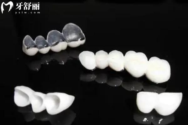 宿遷看牙貴不貴？宿遷口腔醫(yī)院價格表
