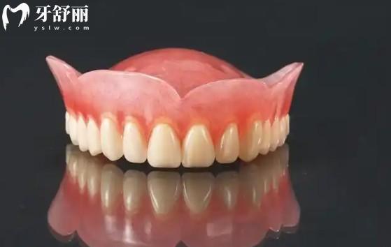 吸附性義齒多少錢？價格表與影響因素