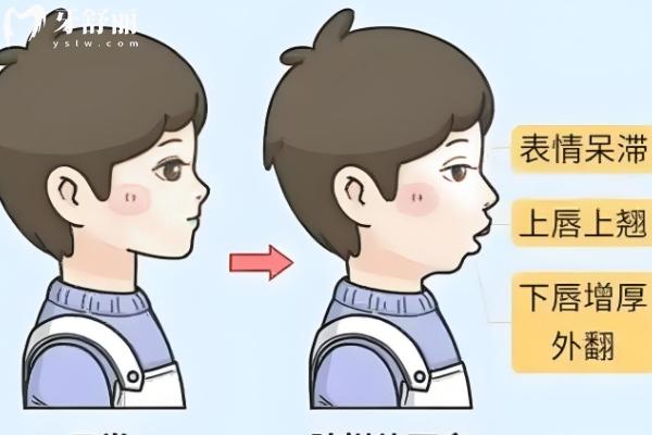 懷化牙齒矯正大概要花費多少錢