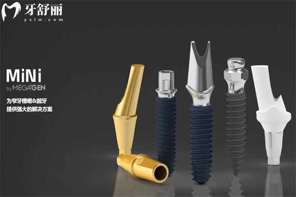 青島種植牙多少錢一顆2025價格表已出 單顆牙2k元+全口種牙3.6w元+