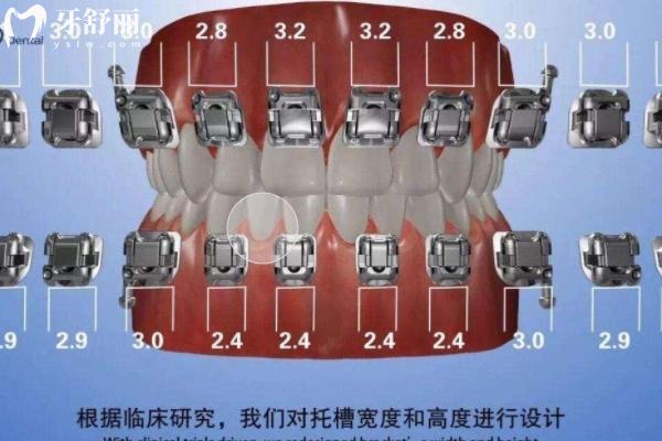 2025上海牙套價(jià)目表更新