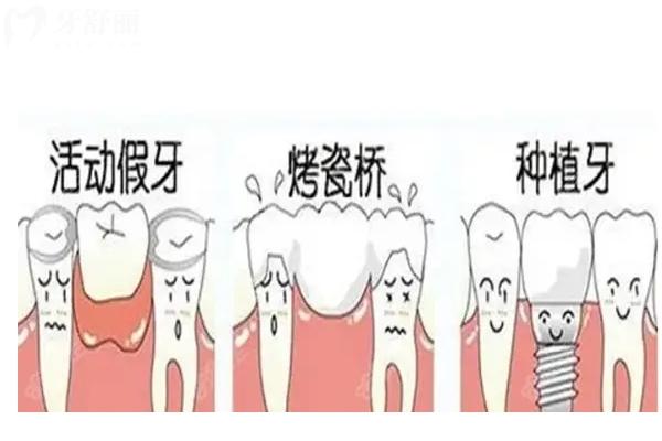 漢中口腔醫(yī)院收費價目表2025