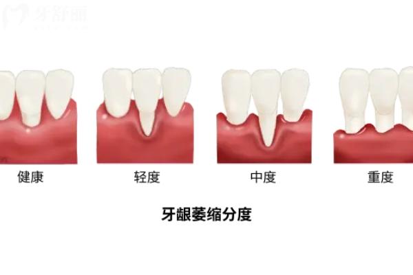 2025寶雞口腔醫(yī)院收費標(biāo)準(zhǔn)