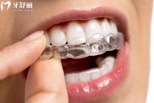 宜春施美爾口腔收費標準，補牙、種植、矯正、根管、拔牙等收費全知曉