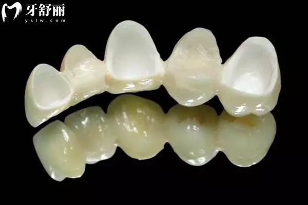 深圳各大口腔醫(yī)院看牙多少錢