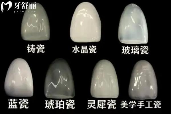 珠海牙齒貼面哪家醫(yī)院好？