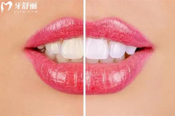 蕪湖牙科醫(yī)院收費(fèi)標(biāo)準(zhǔn)