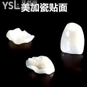 南寧柏樂口腔美加瓷貼面收費價格怎么樣？
