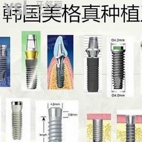 西安中諾口腔醫(yī)院韓國(guó)美格真種植牙價(jià)格表