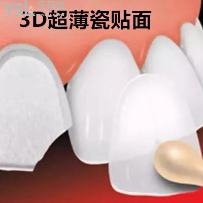 沈陽歡樂口腔3D超薄美牙瓷貼面價格貴不貴？僅供參考顧客評價