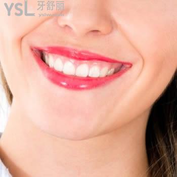 沈陽(yáng)歡樂(lè)口腔皓齒美白靠譜嗎？?jī)r(jià)格貴不？且看醫(yī)生怎么說(shuō)？