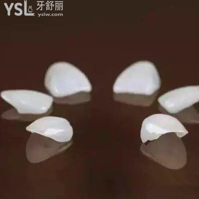 沈陽億美佳口腔納米仿生樹脂貼面收費標(biāo)準(zhǔn)