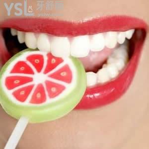 重慶美奧口腔冷光美白收費(fèi)合理嗎？