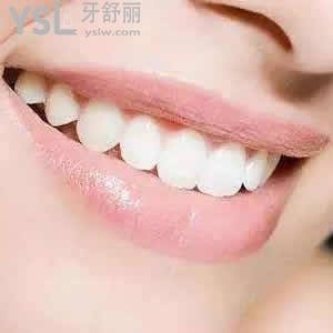 重慶成佳牙博士口腔醫(yī)院隱形矯正（正雅）價格貴嗎？