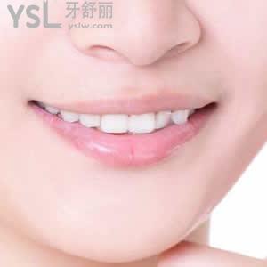 重慶牙博士口腔醫(yī)院收費標(biāo)準(zhǔn)之時代天使隱形矯正（冠軍版）多少錢？