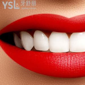 好消息：昆明美奧口腔醫(yī)院正雅全隱形矯正（兩人拼團(tuán)）驚爆價(jià)！