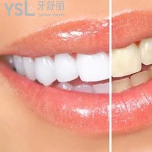 長沙口腔醫(yī)院哪家好？長沙好大夫之皓齒美白價(jià)格表收費(fèi)一覽