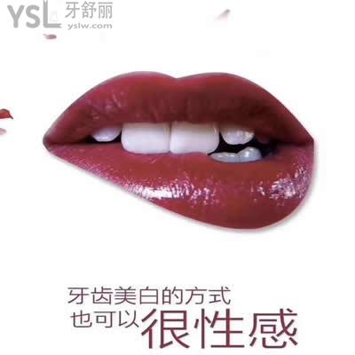 冰瓷牙貼面能維持多久？