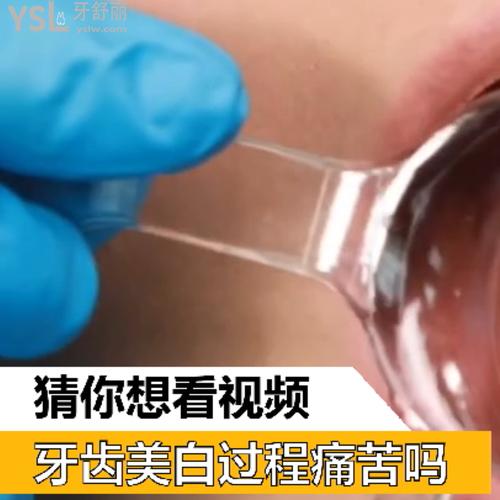 牙齒美白過程痛苦嗎？