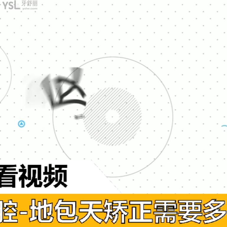 地包天矯正需要多長(zhǎng)時(shí)間？