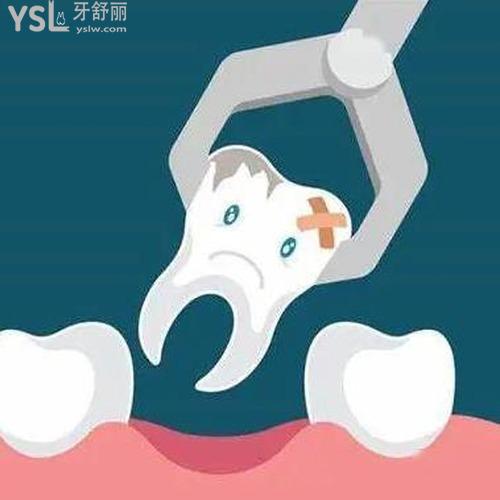 拔牙后需要注意什么事項？