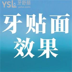 牙貼面成效如何？
