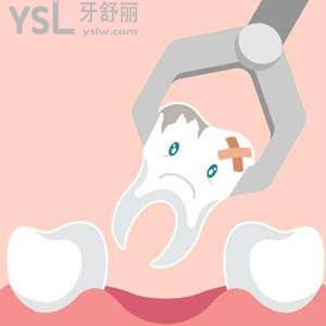 成人牙齒松動(dòng)能自己拔掉嗎？