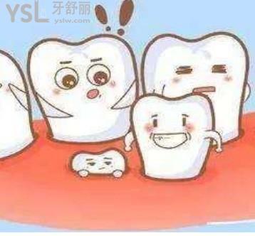 成人為什么還會(huì)有多生牙 還要拔嗎？