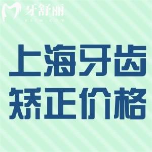 全新上海牙齒矯正價格表:全年齡金屬矯正6000+隱形矯正20000+更劃算