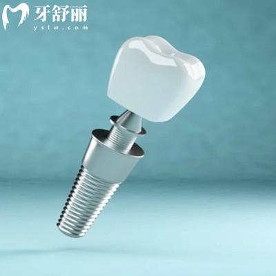 更新西安種植牙收費價目表：單顆2369/半口18878元/全口30000元起