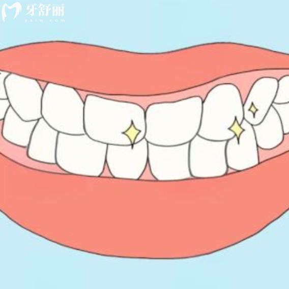 30歲做了滿口烤瓷牙能用一輩子嗎？老了還能用嗎？