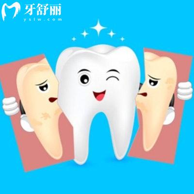 牙齒美白的方法哪種有效？是不是智商稅？