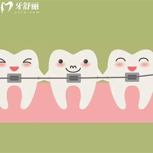 北京兒童地包天矯正需要多少錢?揭曉2025正畸價(jià)格50000+及熱門醫(yī)院