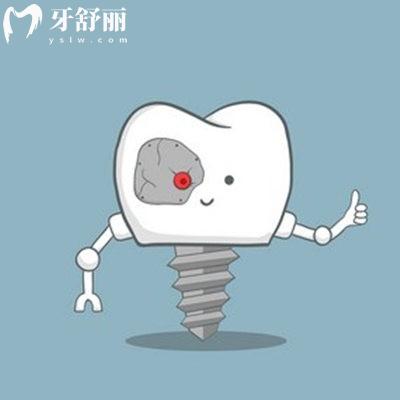 廣州廣大口腔醫(yī)院免費種牙是真的嗎,瞧超雞凍500顆進口種植牙免費種不騙人