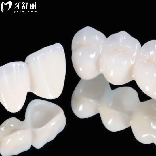 牙冠國(guó)產(chǎn)VS進(jìn)口：是智商稅還是物有所值？教你按牙選材不花冤枉錢